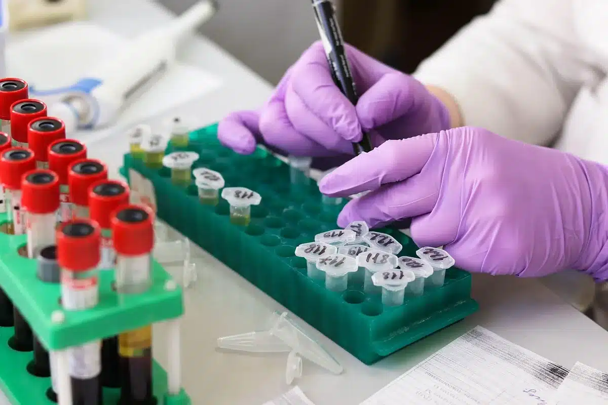 Fiole de prélèvement et compte‑rendu de laboratoire sur une table