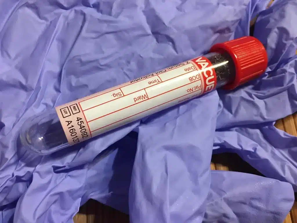 Glucomètre numérique et verre de jus de fruit sur surface neutre, symbolisant le test et la correction rapide de la glyc