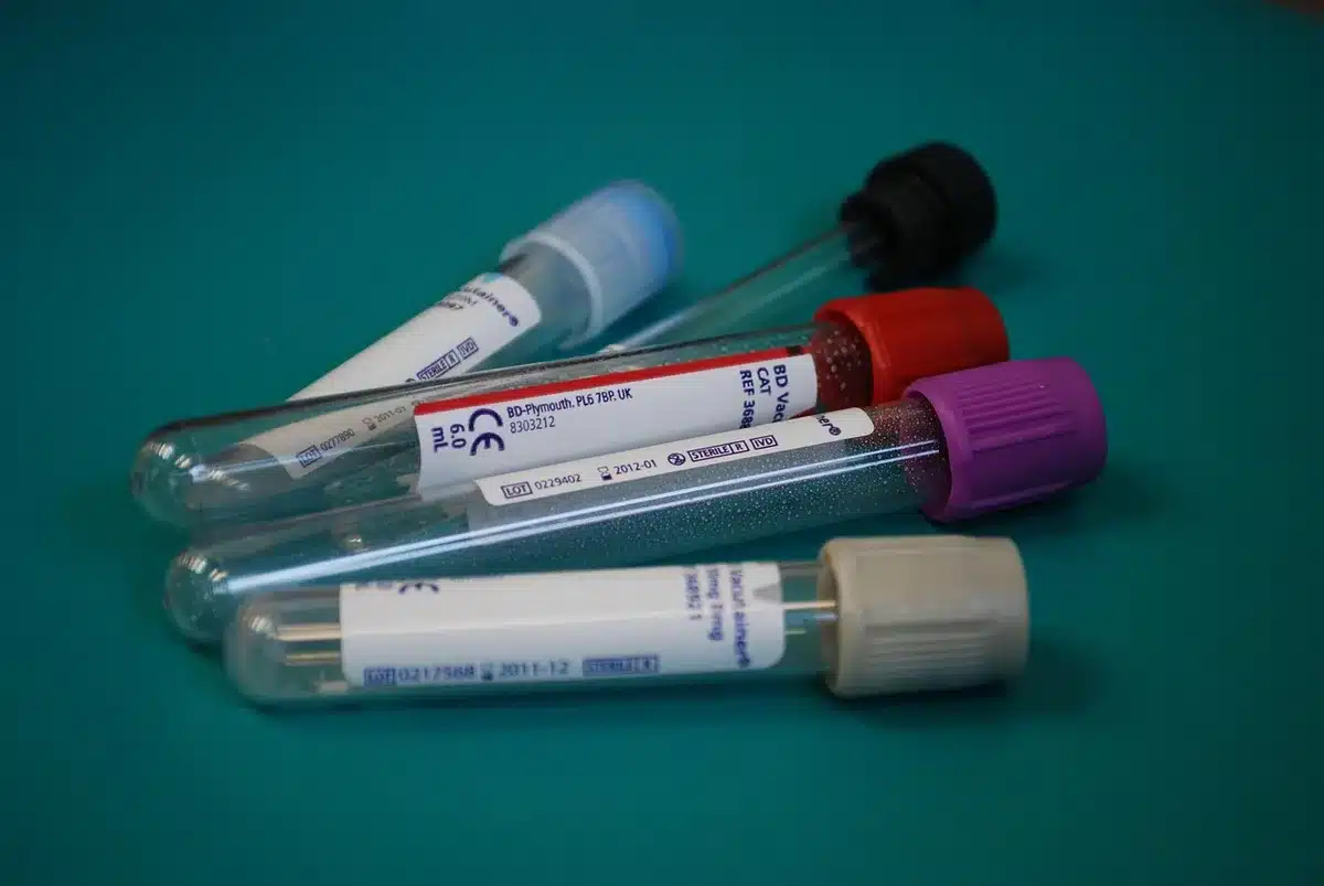 Technicien de laboratoire analysant un échantillon de sang avec résultats médicaux affichés