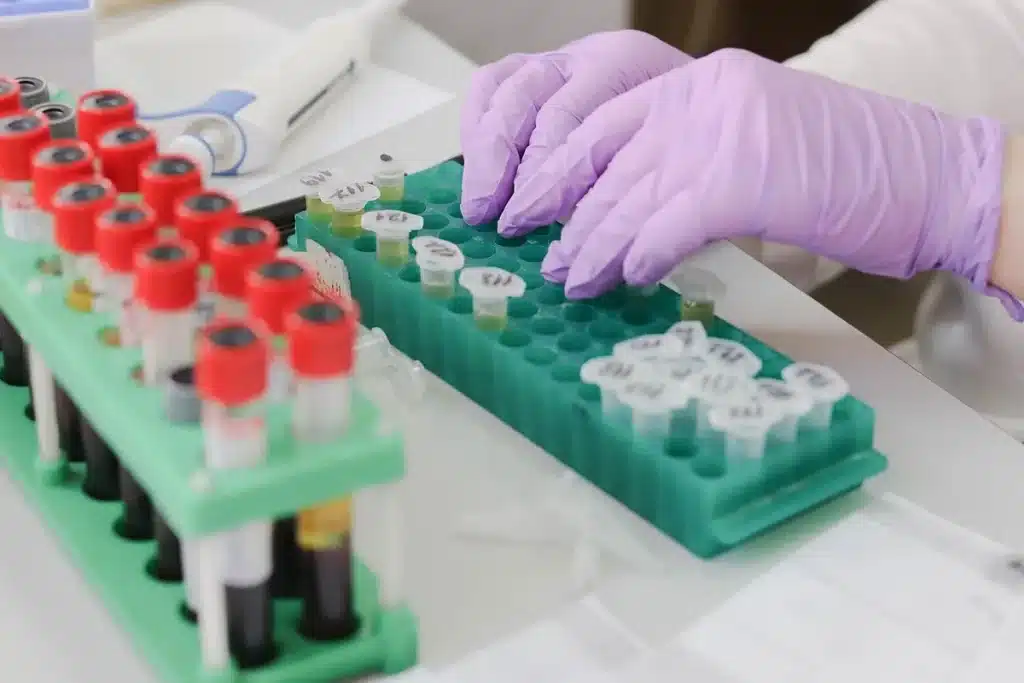 prise de sang et formulaire de laboratoire près d'une fenêtre en journée