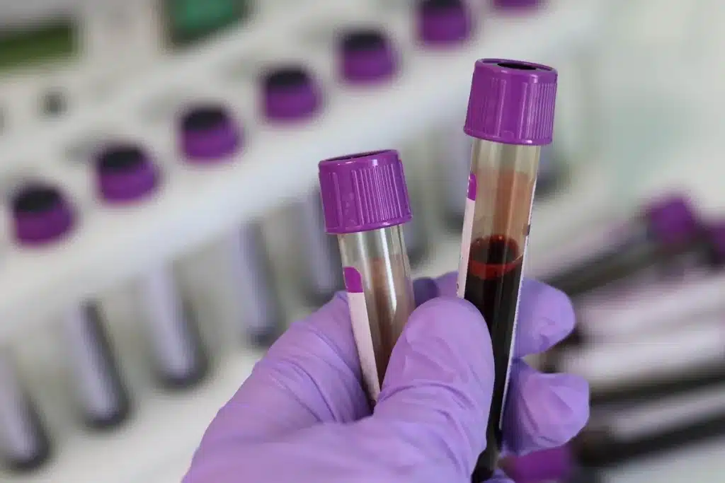 Couloir de clinique vide, mains anonymes saisissant un formulaire de prise de sang