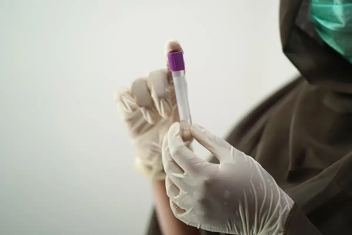Prélèvement sanguin en tube EDTA pour une numération formule sanguine