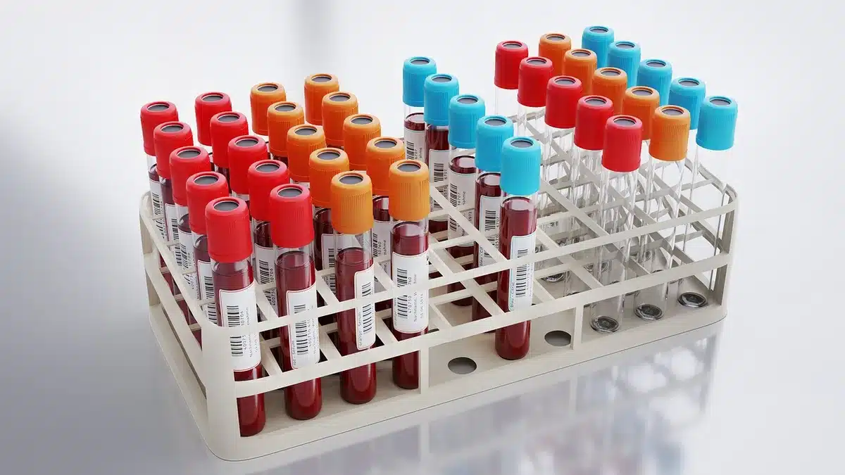 Technicien de laboratoire analysant un échantillon de sang et des résultats de test sur un bureau médical